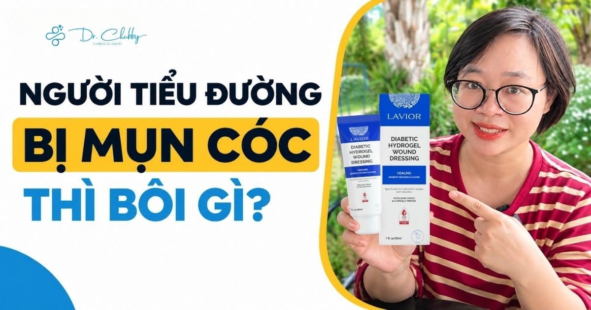 Người Tiểu Đường Bị Mụn Cóc Thì Bôi Gì?