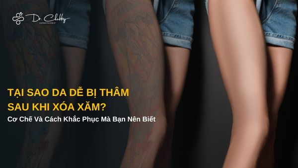 Lành Thương Sau Xăm Và Xóa Xăm: Cơ Chế Phục Hồi, Nguy Cơ Và Cách Chăm Sóc Đúng Chuẩn Y Khoa