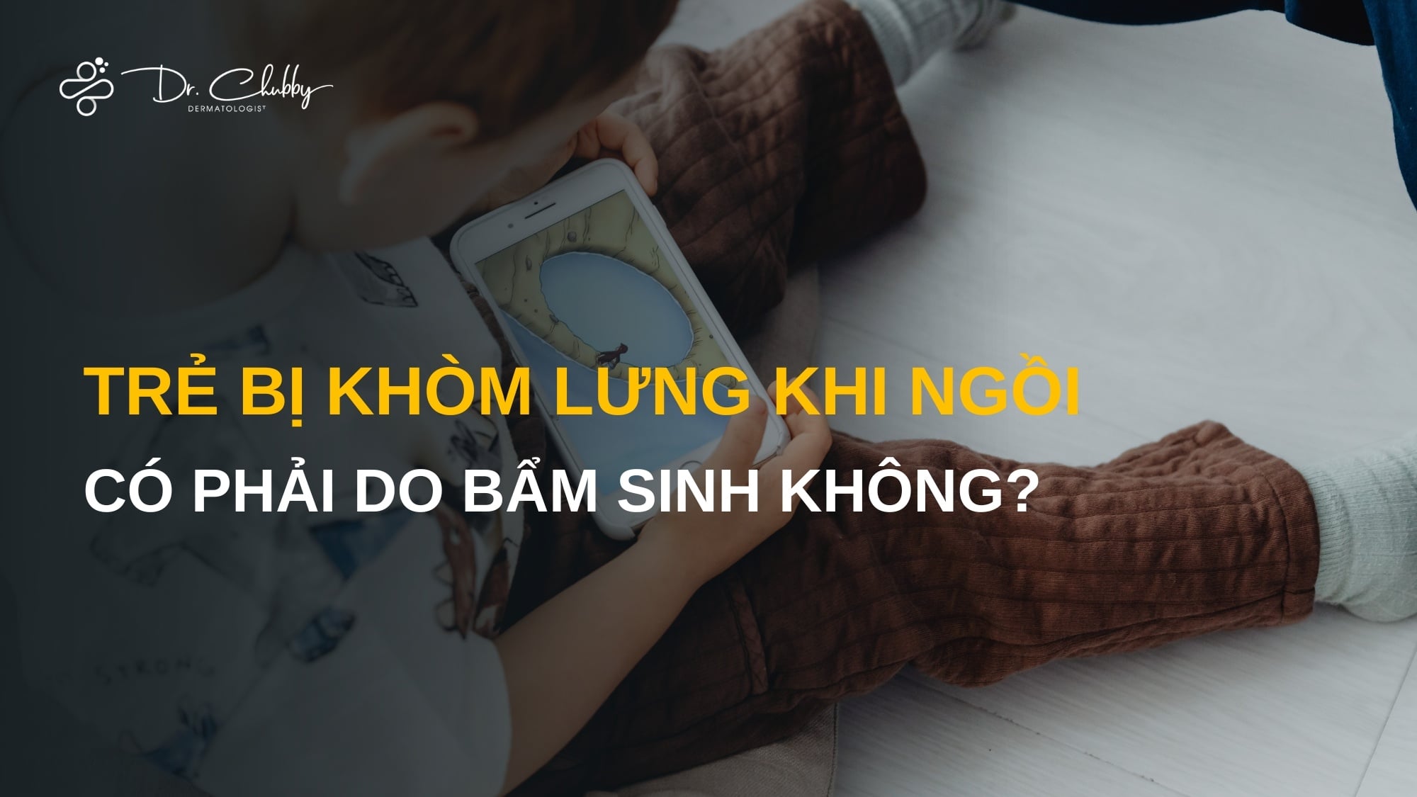 Trẻ bị khòm lưng khi ngồi có phải do bẩm sinh không? Đây là điều ba mẹ cần biết