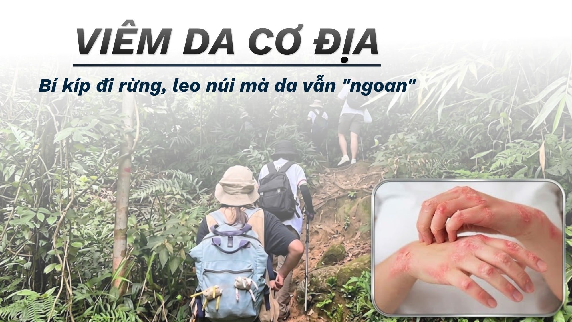 CHÀM VIÊM DA CƠ ĐỊA: LÀM SAO ĐỂ ĐI RỪNG, LEO NÚI, TREKKING TRAIL MÀ DA VẪN 