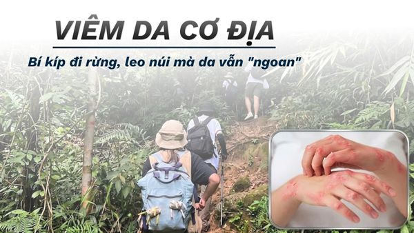CHÀM VIÊM DA CƠ ĐỊA: LÀM SAO ĐỂ ĐI RỪNG, LEO NÚI, TREKKING TRAIL MÀ DA VẪN 