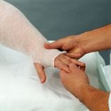 Những dấu hiệu sớm của bệnh phù mạch bạch huyết là gì?