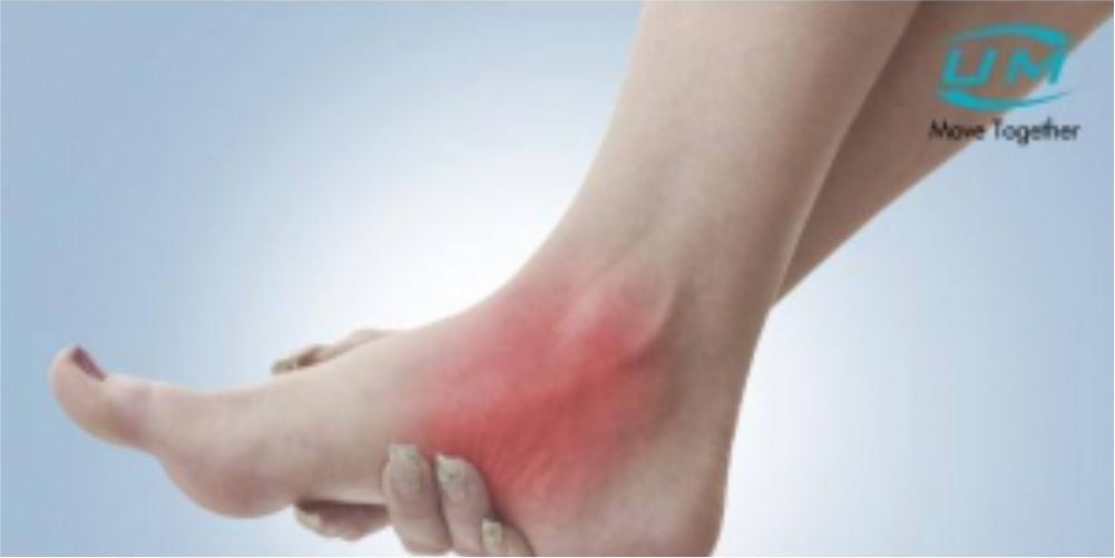 Đau cổ chân ở mức độ nào thì cần phải mang sản phẩm có nẹp?