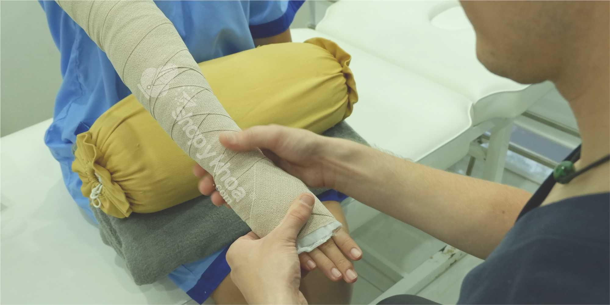 Liệu trình điều trị phù nề hệ bạch huyết