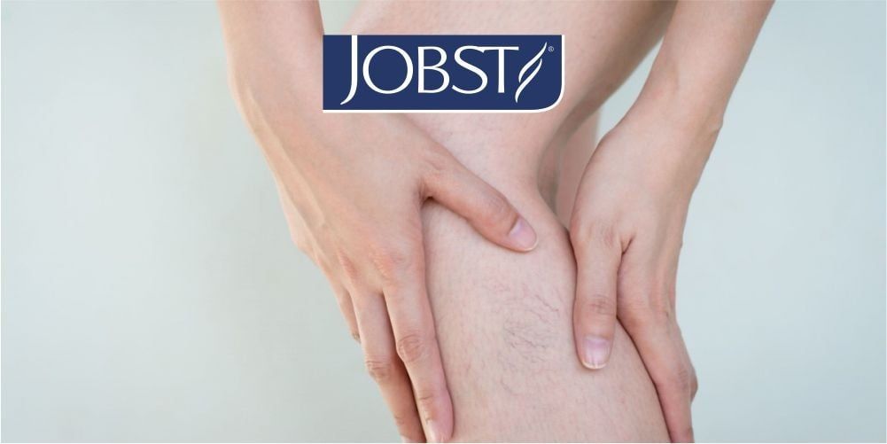 PHÒNG BỆNH HƠN CHỮA SUY TĨNH MẠCH