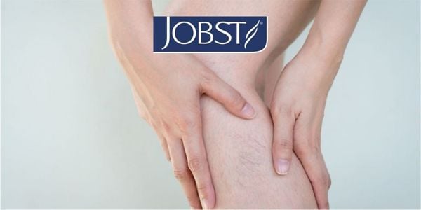 PHÒNG BỆNH HƠN CHỮA SUY TĨNH MẠCH