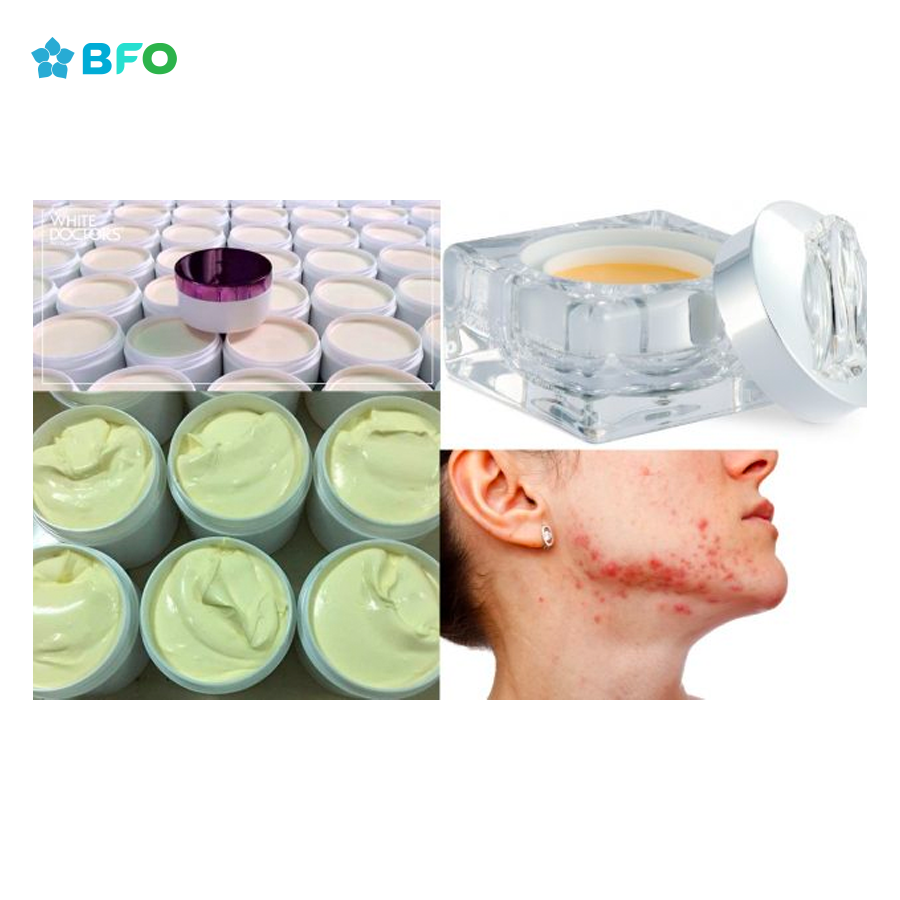 Tác hại của việc dùng kem không rõ nguồn gốc