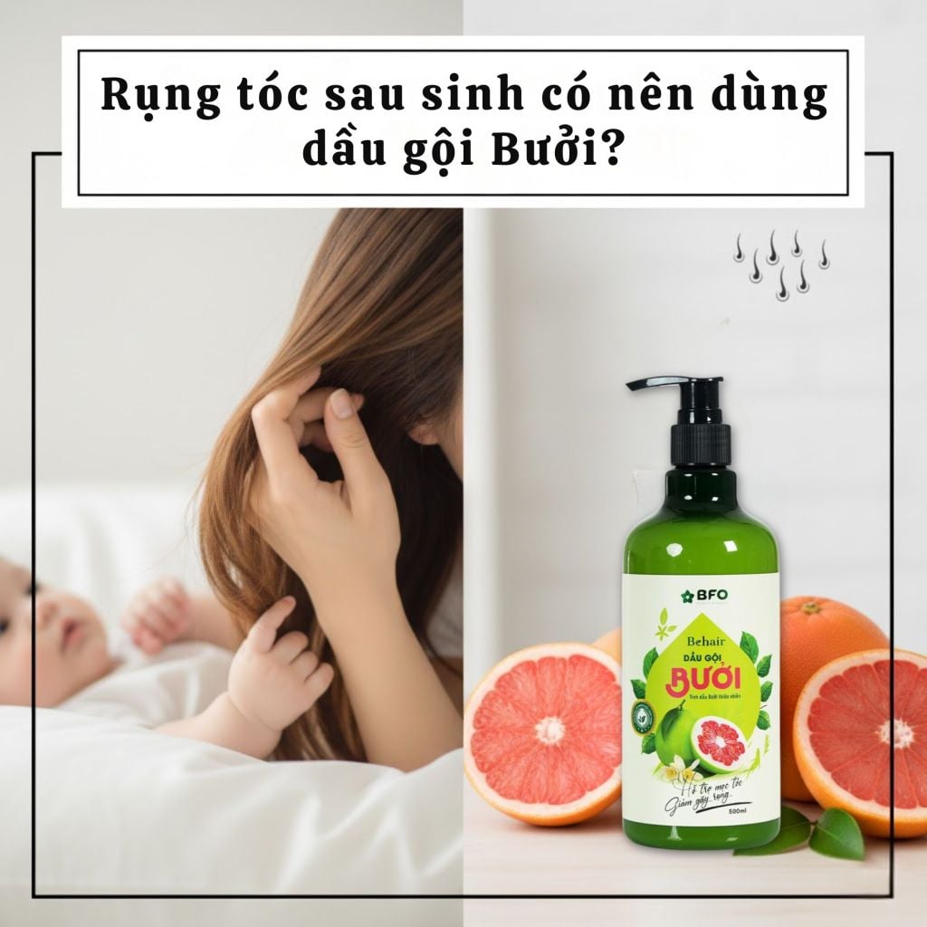 Rụng tóc sau sinh có nên dùng dầu gội bưởi? Giải đáp từ chuyên gia