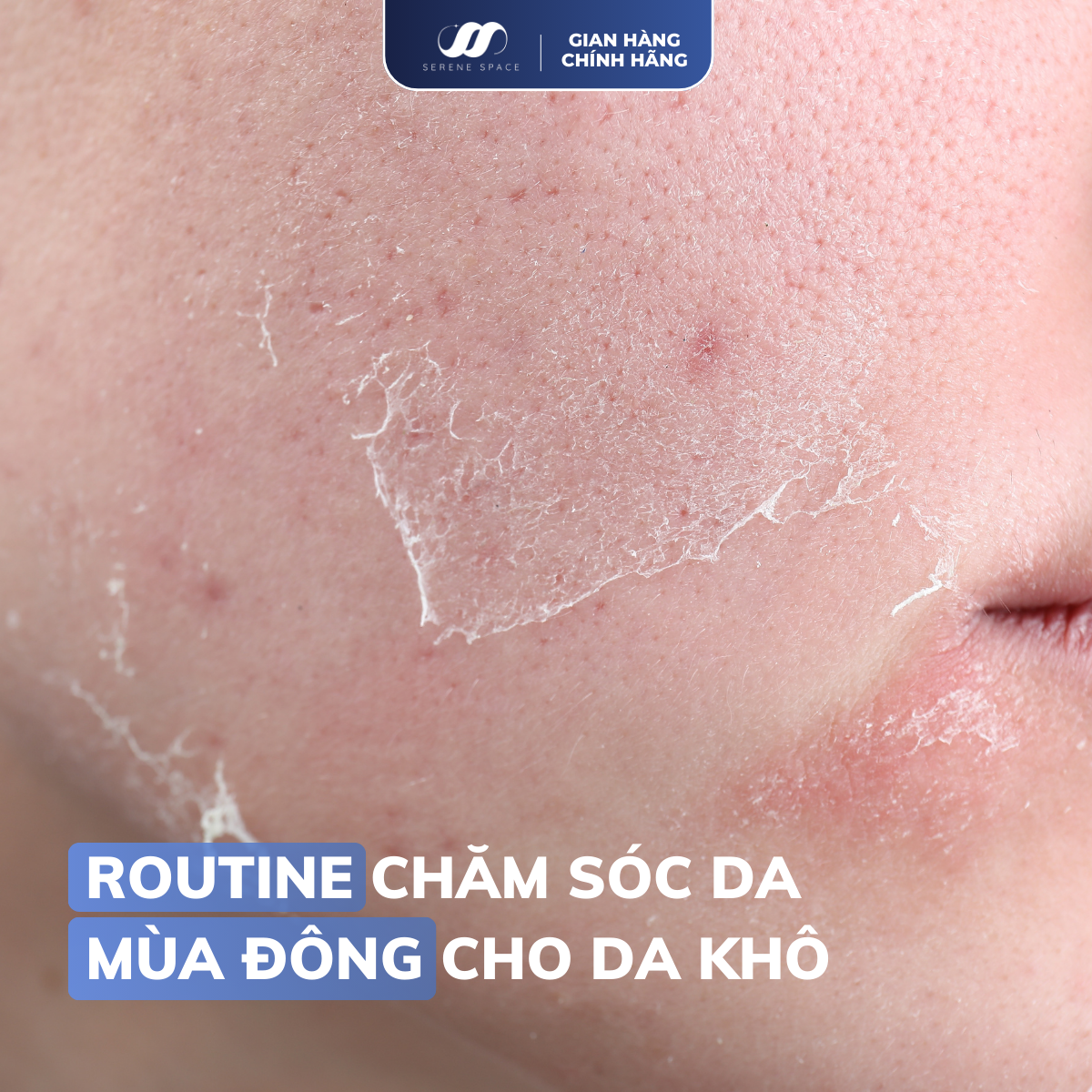 Routine Chăm Sóc Da Mùa Đông Cho Da Khô: Chuyên Gia Chỉ 5 Bước Đơn Giản