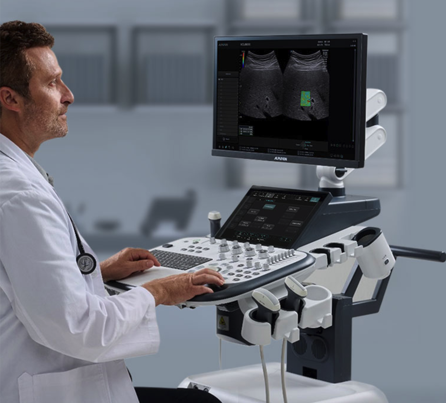 Siêu âm đàn hồi mô – những điều bạn cần biết