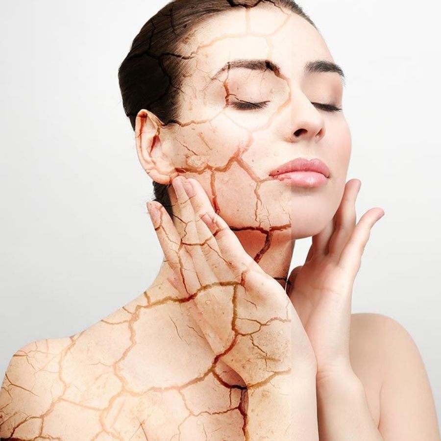 Vì sao da khô nên sử dụng dầu dưỡng để da mềm mịn cả ngày?