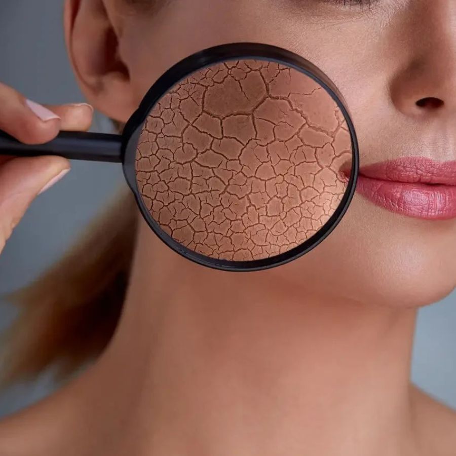 Body oil cho da khô: Bí quyết dưỡng ẩm chuyên sâu cho làn da mềm mượt cả ngày