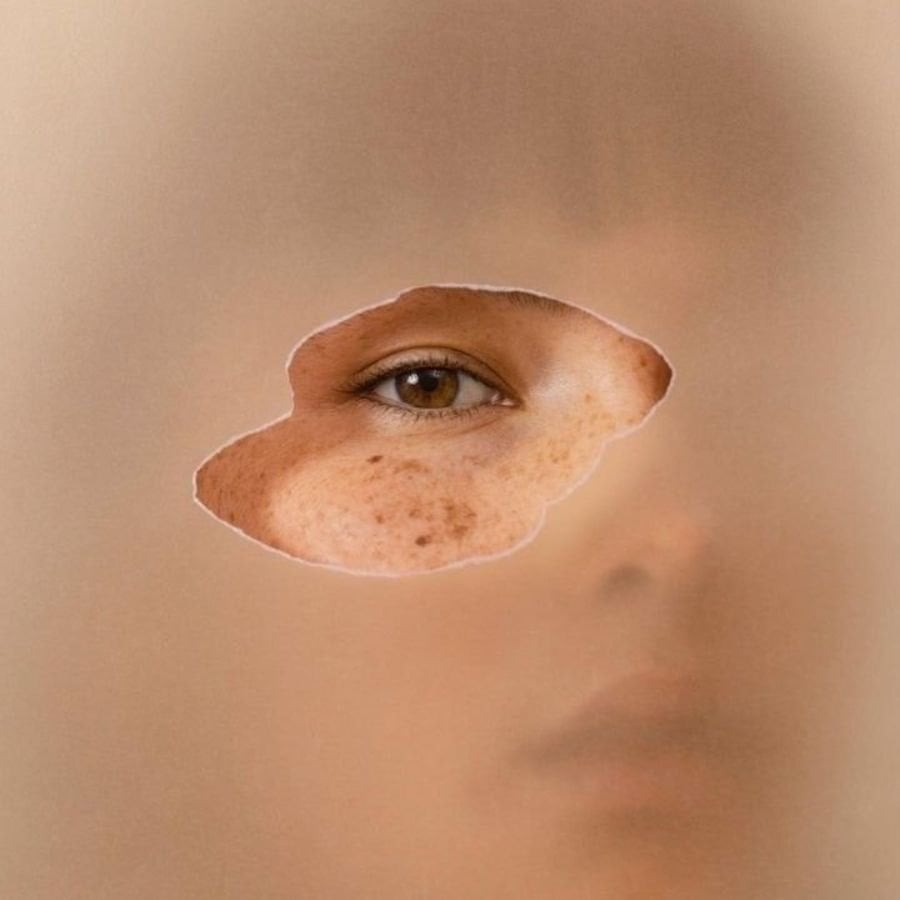 Vì sao da nhạy cảm nên sử dụng dầu dưỡng da