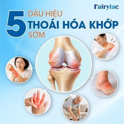 5 DẤU HIỆU THOÁI HÓA KHỚP SỚM – ĐỪNG CHỦ QUAN KHI CƠ THỂ ĐÃ “LÊN TIẾNG”