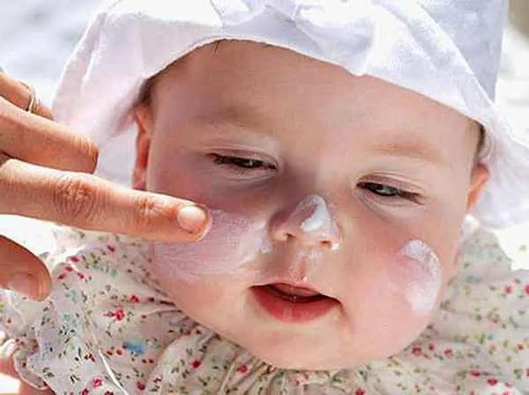 Những điều mẹ NÊN và KHÔNG NÊN làm khi bé bị rôm sẩy