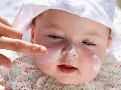 Những điều mẹ NÊN và KHÔNG NÊN làm khi bé bị rôm sẩy