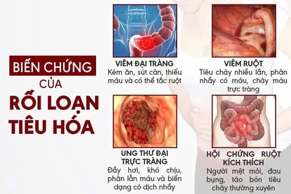 Nguyên Nhân Và Triệu Chứng Điển Hình Của Bệnh Rối Loạn Tiêu Hoá