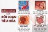 Nguyên Nhân Và Triệu Chứng Điển Hình Của Bệnh Rối Loạn Tiêu Hoá