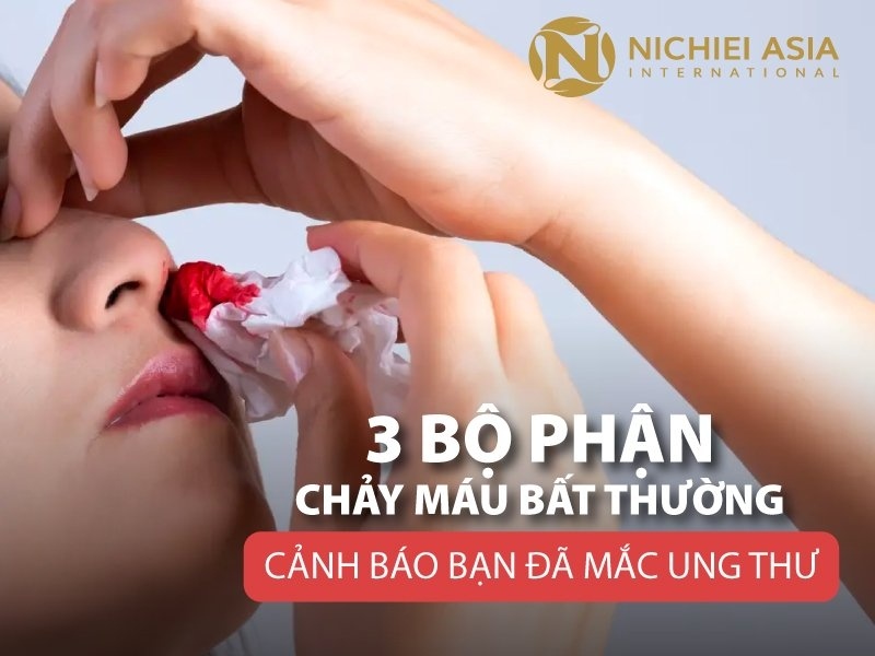 3 Bộ Phận Chảy Máu Bất Thường Cảnh Báo Mắc Ung Thư