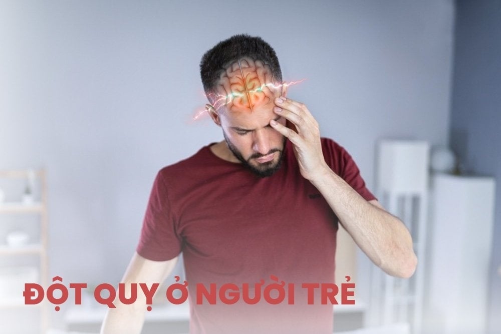 8 nguyên nhân đột quỵ ở người trẻ cần đặc biệt lưu ý