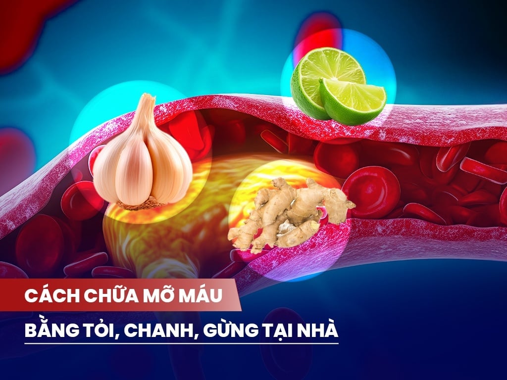 Cách giảm mỡ máu tại nhà bằng tỏi, chanh, gừng