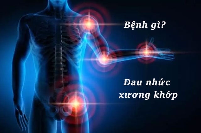 Giải pháp mới hỗ trợ cho bệnh xương khớp bạn biết chưa?