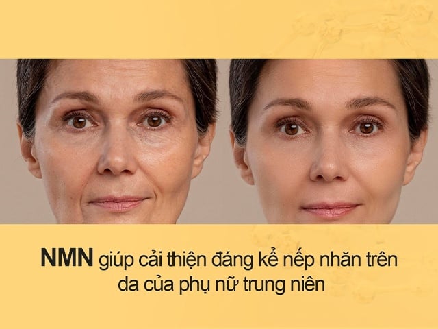 Mỹ phẩm NMN chỉ là 