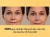 Mỹ phẩm NMN chỉ là 