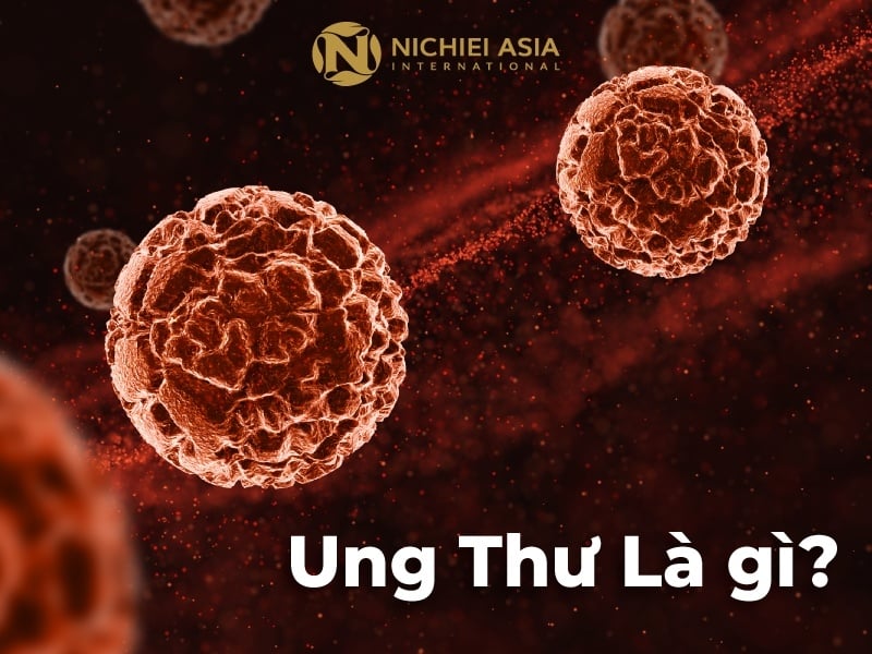 Ung thư tuy khó chữa nhưng có thể phòng ngừa!