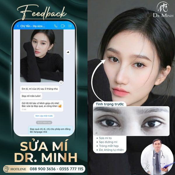 Liên Vy – 26 tuổi: Cô tiếp viên hàng không và hành trình lặng lẽ đi tìm lại đôi mắt từng khiến cô suýt đánh mất sự nghiệ