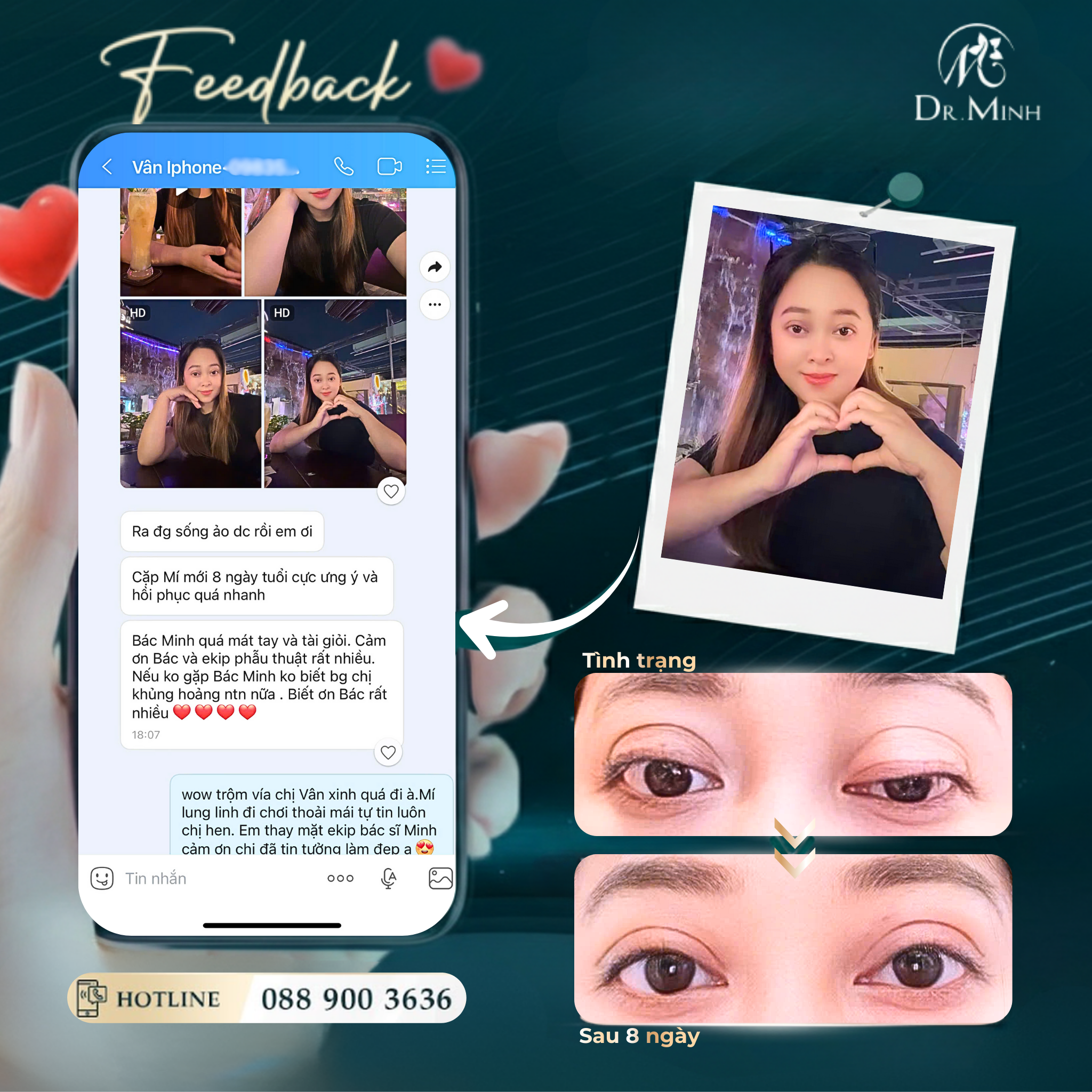 Từ nhược cơ mi đến mí hỏng nặng - người phụ nữ kinh doanh đã vượt qua biến chứng mí mắt cùng Dr.Minh như thế nào?