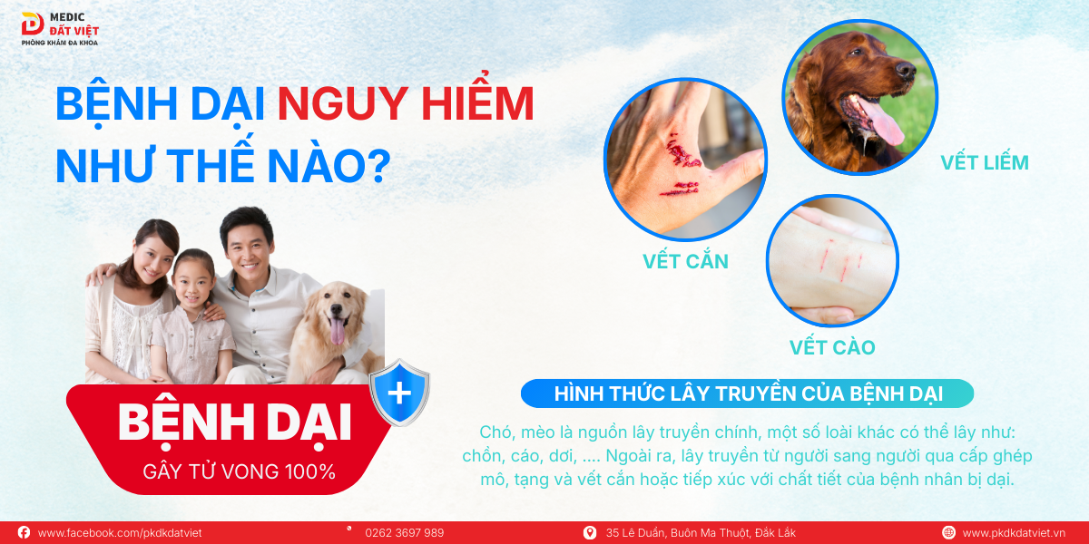 Bệnh Dại Nguy Hiểm Như Thế Nào?