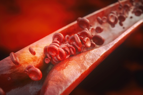 Why Do Blood Vessels Swell During Infection?