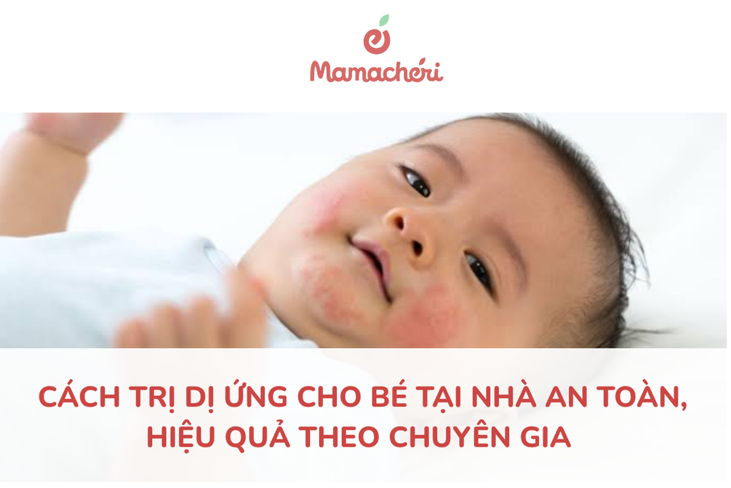 Cách trị dị ứng cho bé tại nhà an toàn, hiệu quả theo chuyên gia