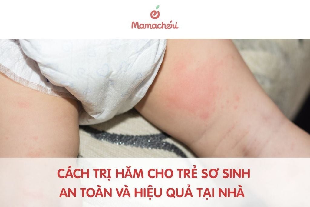 Cách trị hăm cho trẻ sơ sinh an toàn và hiệu quả tại nhà