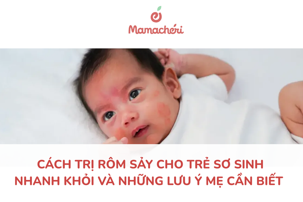 Cách trị rôm sảy cho trẻ sơ sinh nhanh khỏi và những lưu ý mẹ cần biết