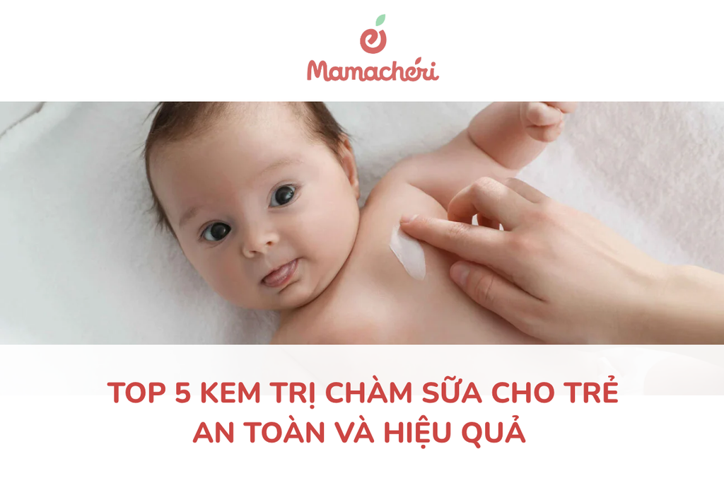 Top 5 kem trị chàm sữa cho trẻ an toàn và hiệu quả