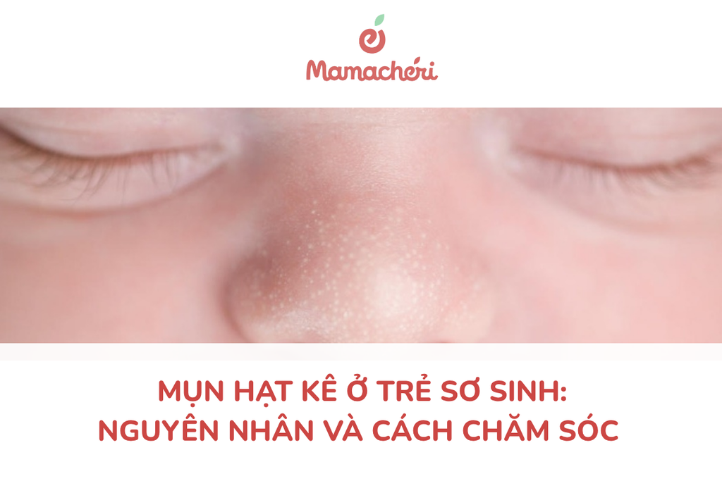 Mụn hạt kê ở trẻ sơ sinh: Nguyên nhân và cách chăm sóc
