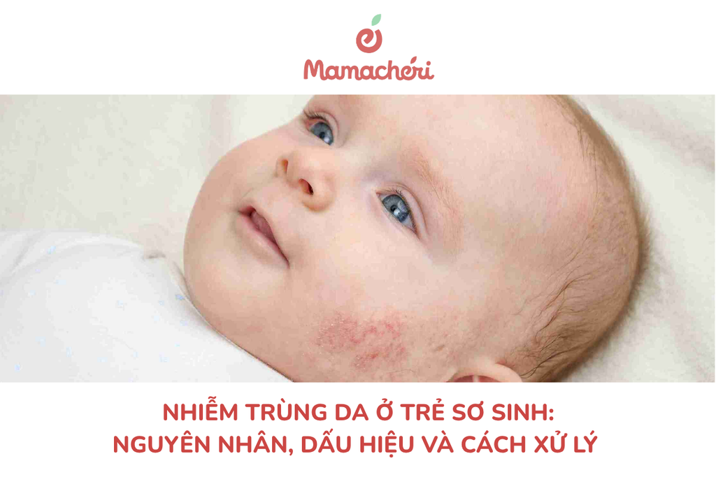 Nhiễm trùng da ở trẻ sơ sinh: Nguyên nhân, dấu hiệu và cách xử lý