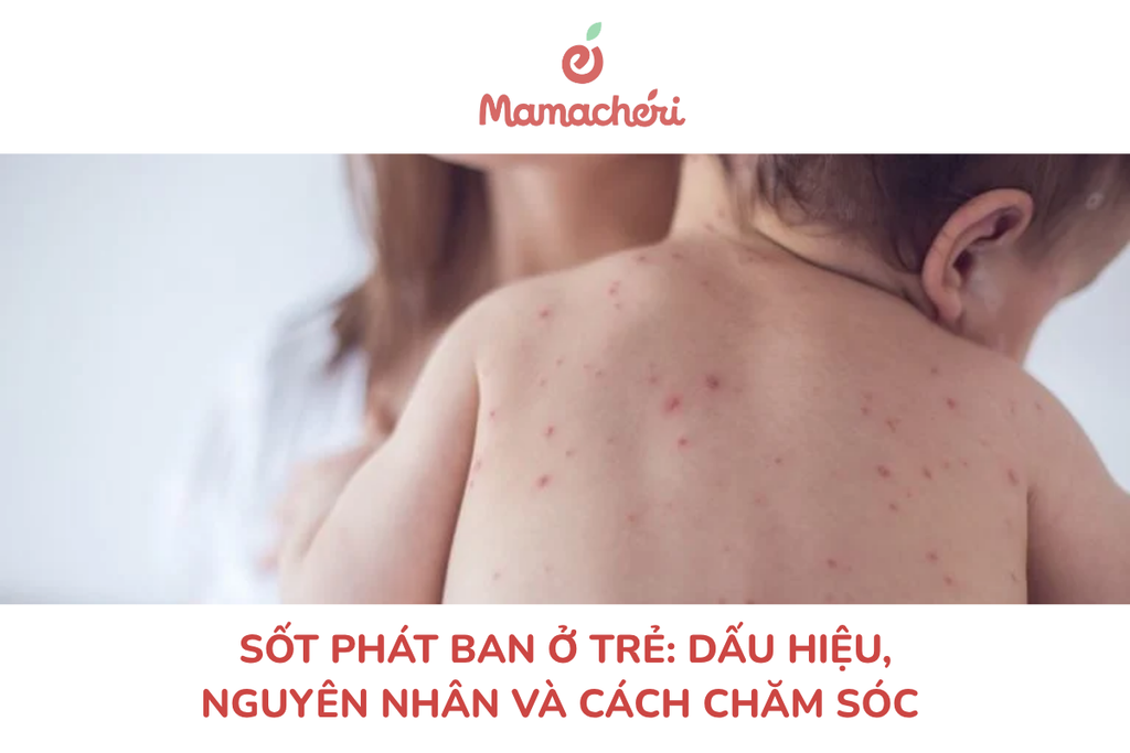 Sốt phát ban ở trẻ: Dấu hiệu, nguyên nhân và cách chăm sóc