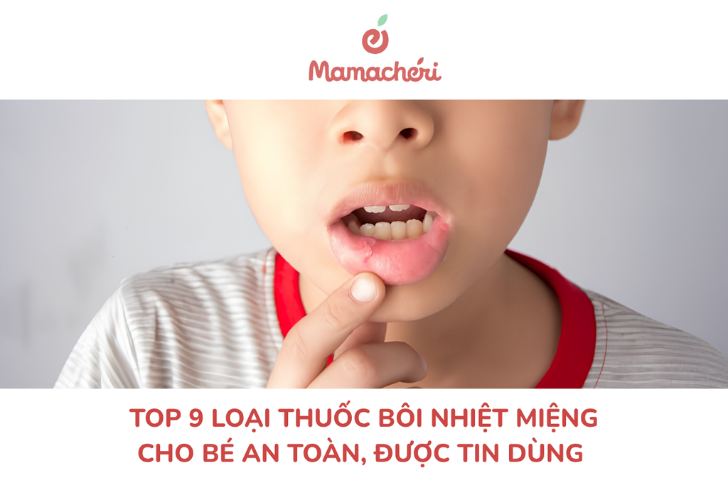 Top 9 loại thuốc bôi nhiệt miệng cho bé an toàn, được tin dùng