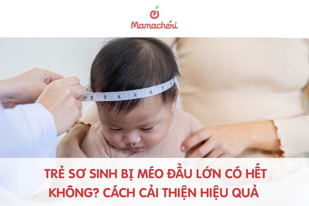 Trẻ sơ sinh bị méo đầu lớn có hết không? Cách cải thiện hiệu quả