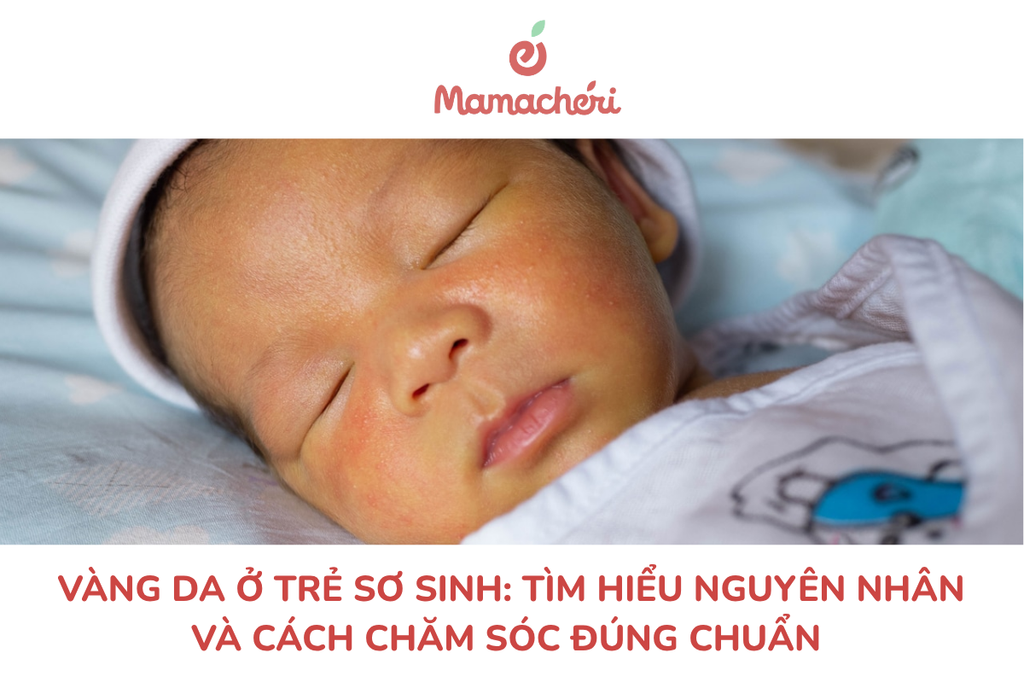 Vàng da ở trẻ sơ sinh: Nguyên nhân và cách chăm sóc đúng chuẩn