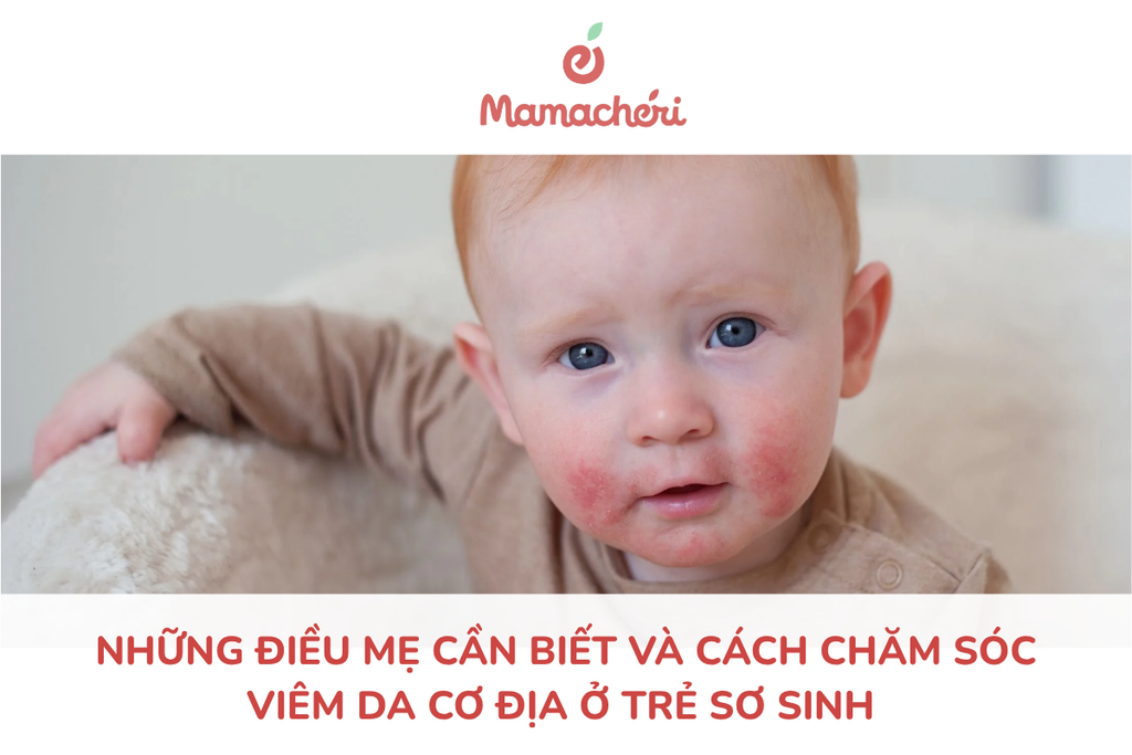 Những điều mẹ cần biết và cách chăm sóc viêm da cơ địa ở trẻ sơ sinh