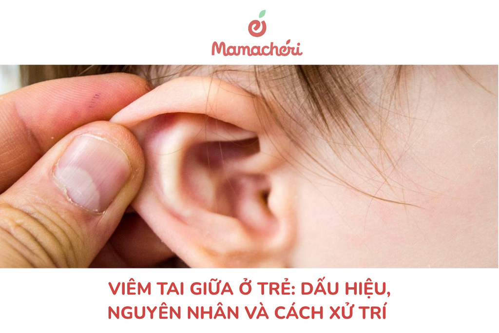 Viêm tai giữa ở trẻ: Dấu hiệu, nguyên nhân và cách xử trí
