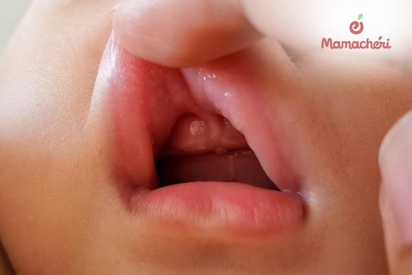 Vệ sinh nướu và răng miệng nhẹ nhàng cho trẻ