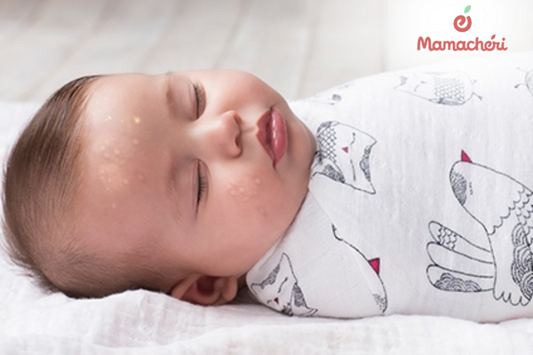 Những lưu ý quan trọng khi áp dụng mẹo dân gian chữa mồ hôi trộm cho bé tại nhà