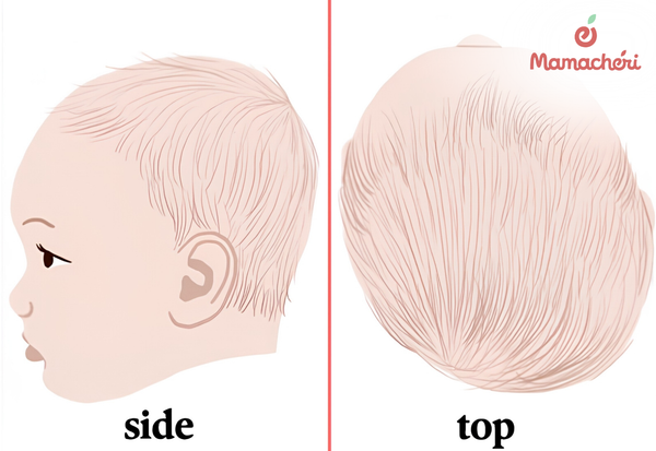 Quan sát sớm giúp mẹ có hướng điều chỉnh tư thế nằm phù hợp cho con.