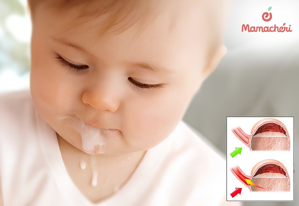Sự chưa hoàn thiện của cơ vòng thực quản là nguyên nhân chính gây trào ngược ở trẻ.