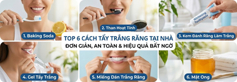 Top 6 cách tẩy trắng răng tại nhà đơn giản nhưng hiệu quả bất ngờ ai cũng làm được
